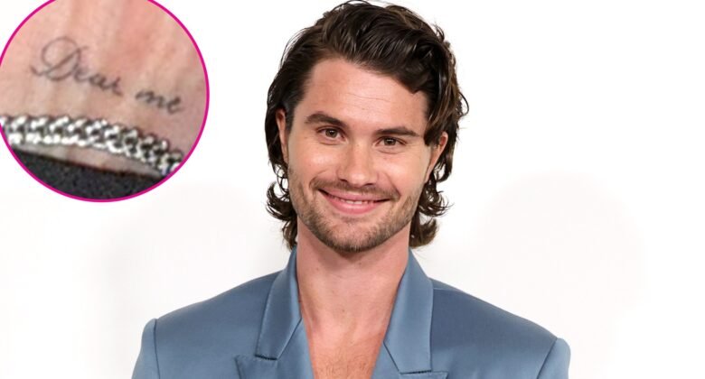 Chase Stokes Reveals He Had So Many Health Issues After Wrapping Outer Banks